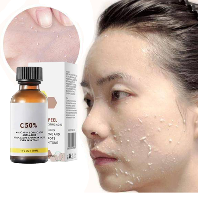 Azelaic Acid Serum - Óleo Esfoliante 3 em 1 para