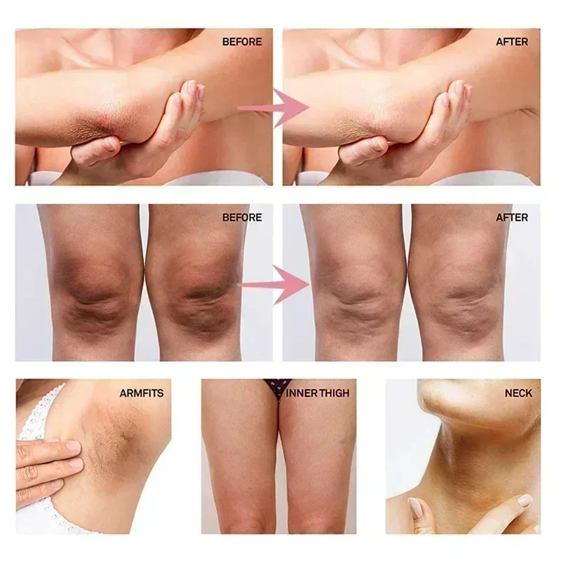 Creme Clareador de Colágeno pa - Skincare Whitening avaliação e preço