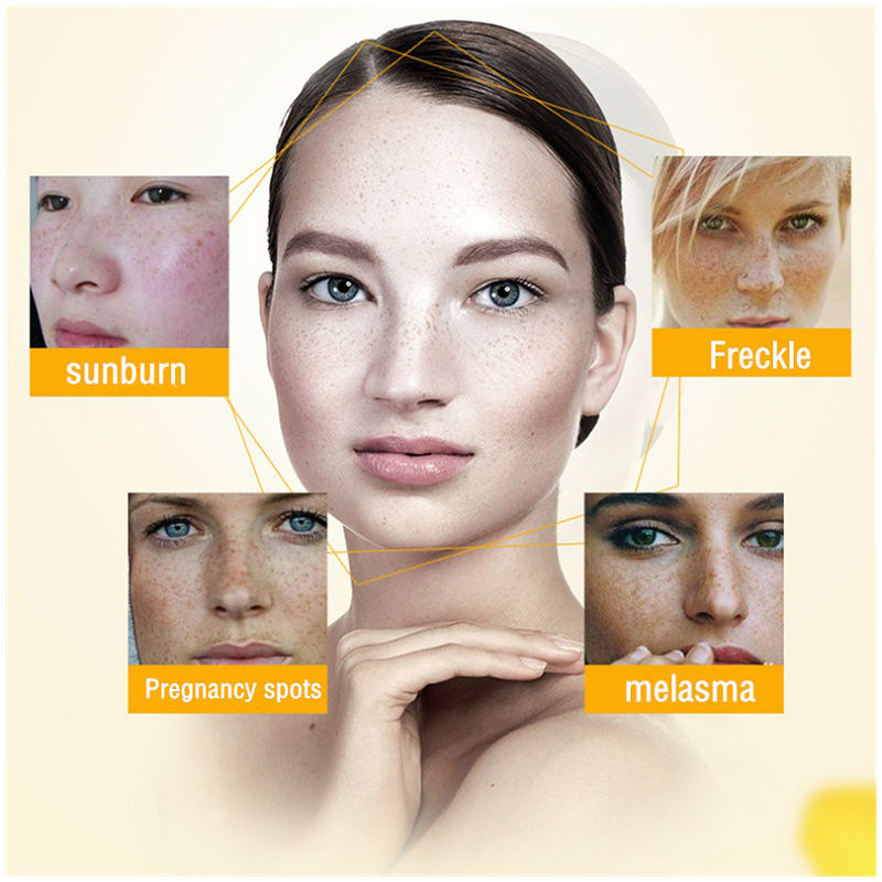 Dimollaure Whitening Freckle C - Skincare Whitening avaliação e preço