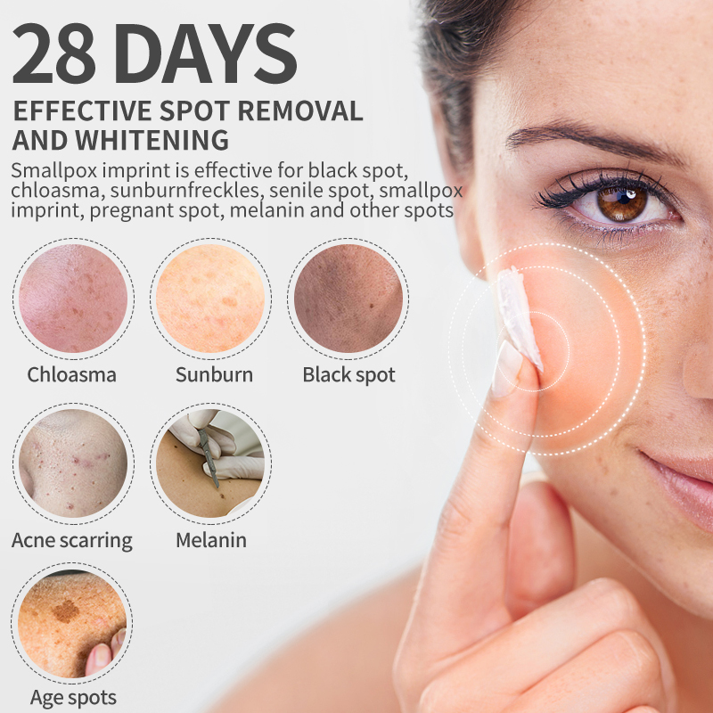 Dimollaure Whitening Freckle C - Skincare Whitening avaliação e preço