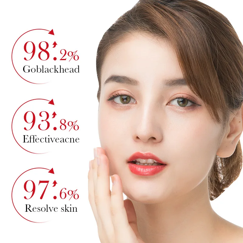 Bioaqua ácido salicílico acne  - Azelaic Acid Serum avaliação e preço