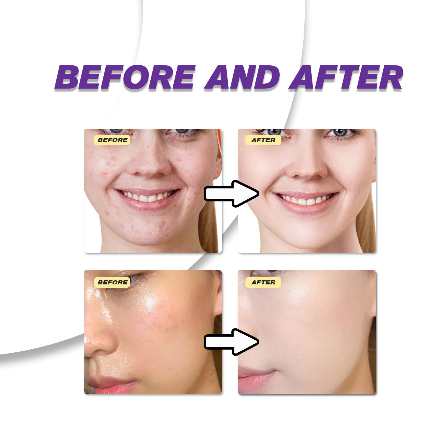 Creme Suave de Ácido Azelaico  - Azelaic Acid Serum avaliação e preço