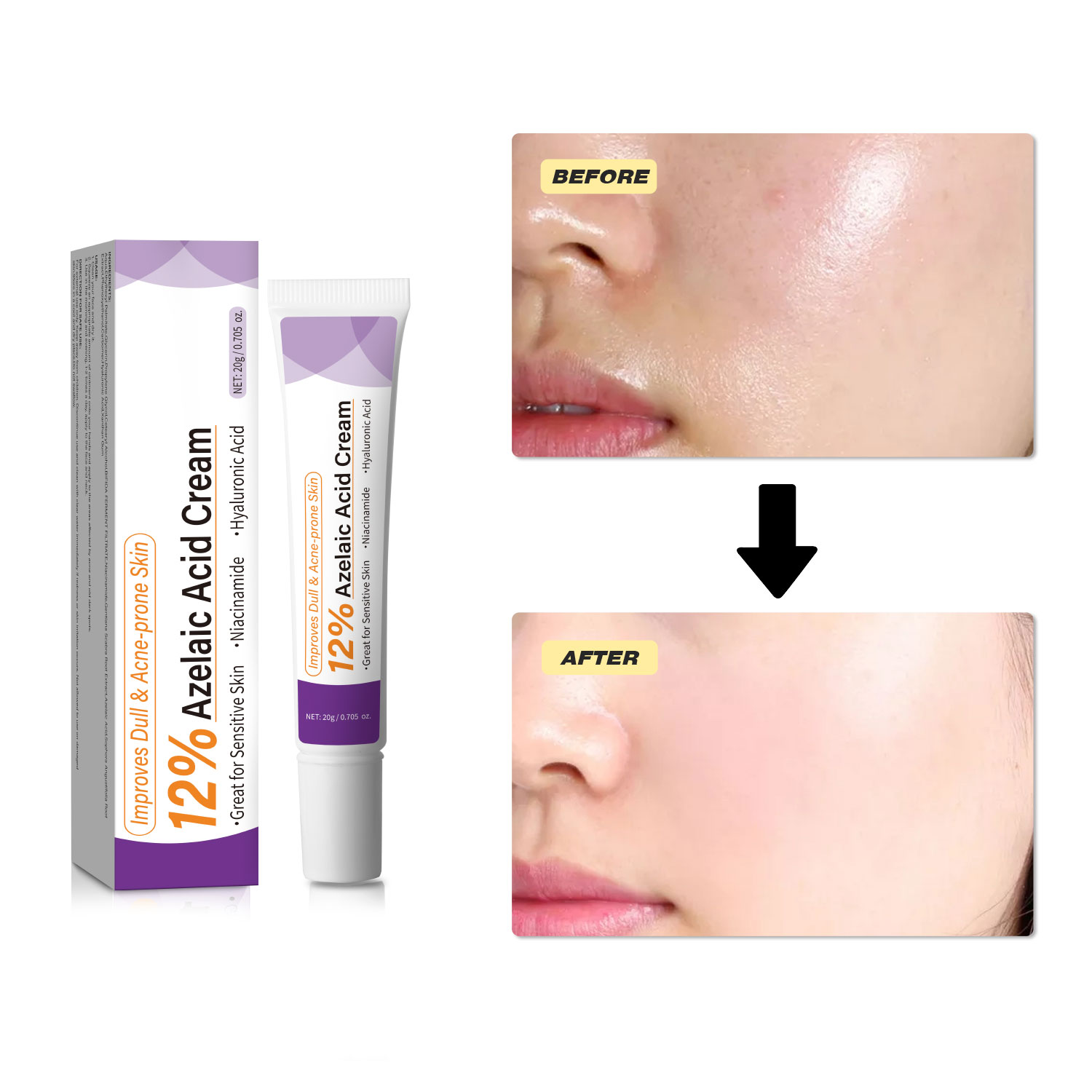 Creme Suave de Ácido Azelaico  - Azelaic Acid Serum avaliação e preço