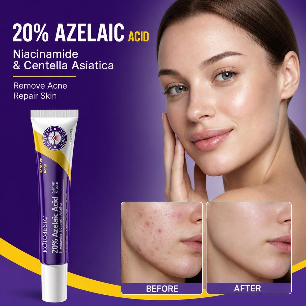 Creme facial hidratante profun - Azelaic Acid Serum avaliação e preço