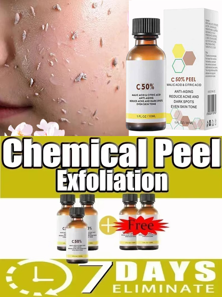 Óleo Esfoliante 3 em 1 para Ma - Azelaic Acid Serum avaliação e preço